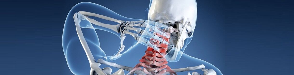Остеохондроз шейного отдела позвоночника человека